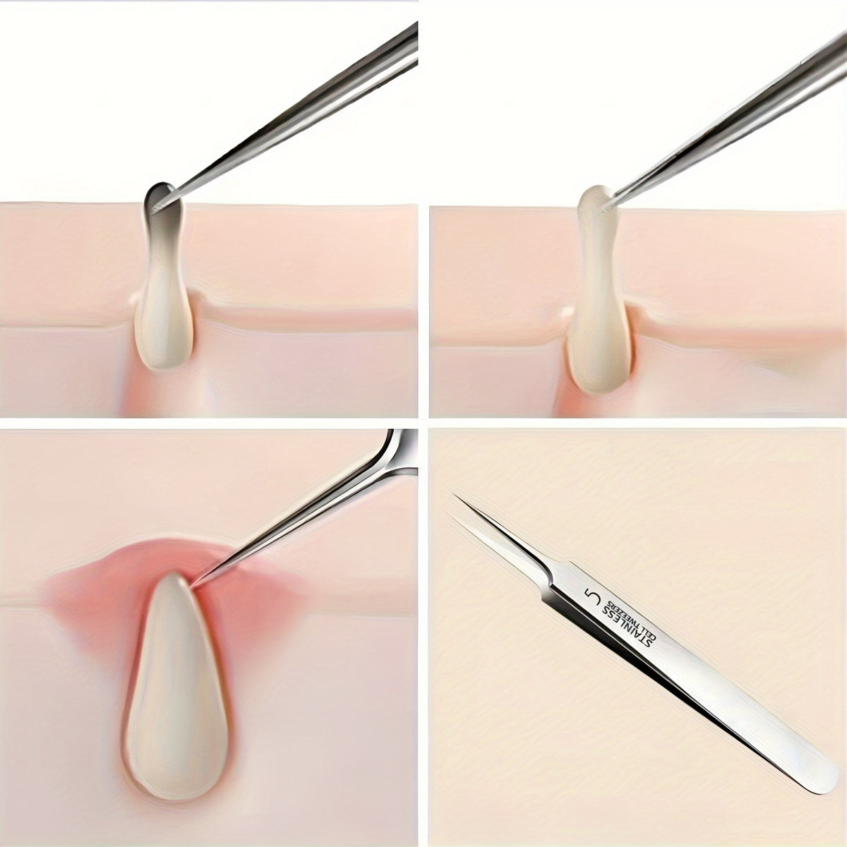 2pcs professional precision ultra fine tip blackhead