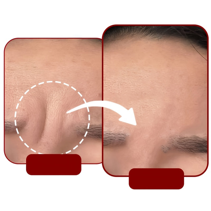 48pcs self   sleep forehead patches reusable elastic